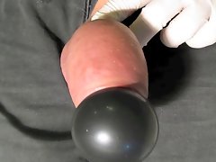 Balloon in the foreskin