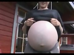 Bulging Babies