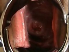 Sensual japanese Extreme EW cervix, speculum, close-up